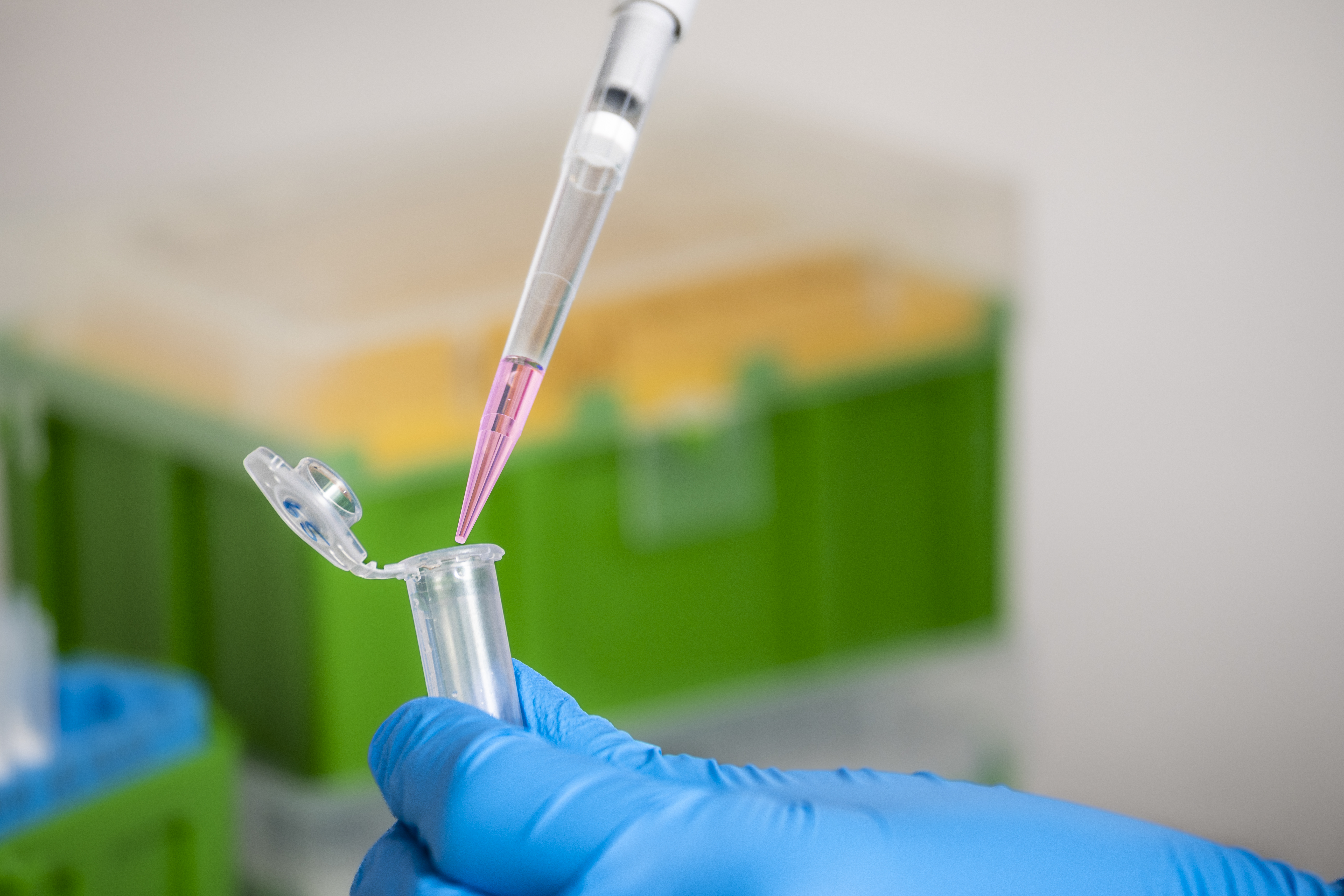 Pipettiervorgang_GynTect